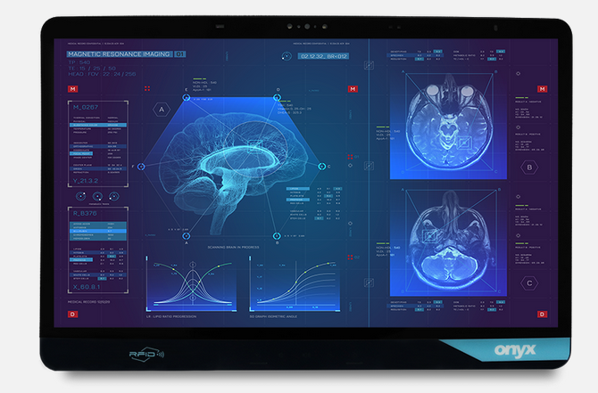 VENUS 24", P-Cap AG Touch, i5 CPU, 16GB RAM, 512GB SSD, WiFi 6E, Imprivata RFID, SCR, 2 XXL Batt's, Power Adaptor, ORION License